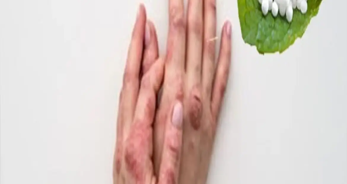 Skin Treatment Featured_images